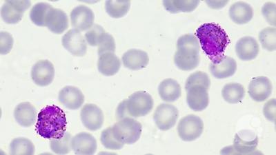 Plasmodium vivax gametocytes