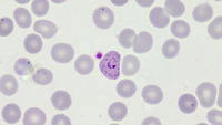 microgametocito de plasmodium vivax