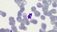 Plasmodium vivax schizont