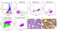 CD33+/CD56+/CD117dim+ atypical plasma cells mimic myeloblasts