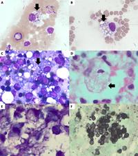 Unwelcome guests in monocytes