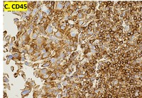 CD45 IHC