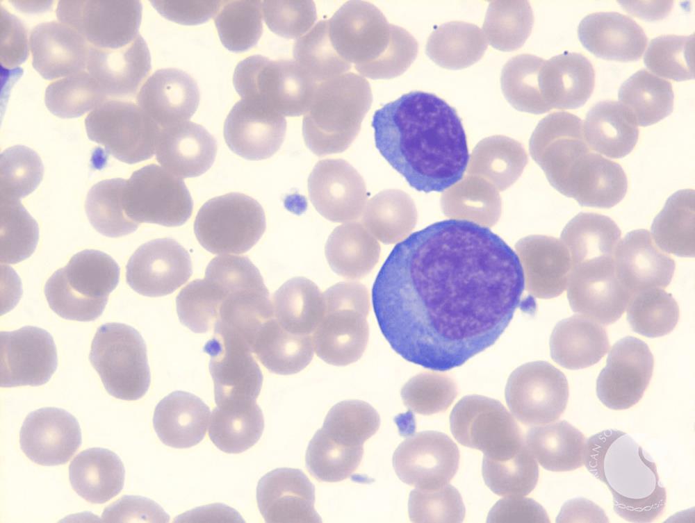Circulating reactive T cells in infectious mononucleosis