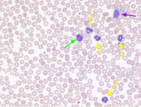 normal-blood-smear