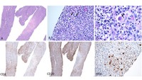 IHC for the lymph node with HSV staining