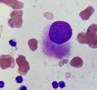 Megakaryocyte With Non Lobated Nucleus