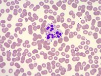 Photomicrographs from a Peripheral Blood Smear
