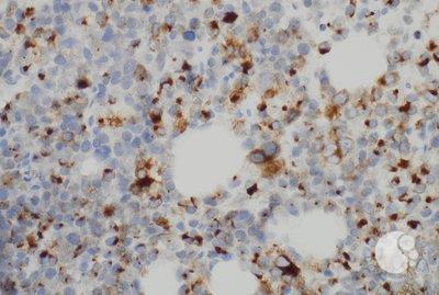 Panel-D, 40X: Higher power image of AE1/AE3 showing dot-like cytoplasmic staining