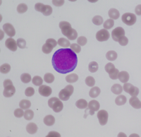 Peripheral blood film