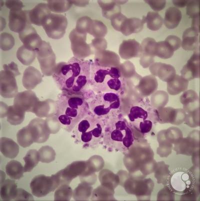 Platelets satellitism