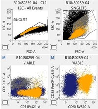 Flowcytometry findings -CD5 CD20 Positive and CD10 negative