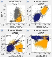 Flowcytometry findings -CD19 CD43 positive with Lambda restriction