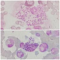 visceral leishmaniasis histology