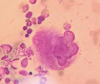 Megakaryocyte producing platelets