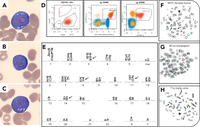 Extranodal presentation of a MYC/BCL6 double-hit lymphoma with 11q aberration in an older patient