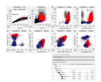 Hairy cell -flowcytometry findings