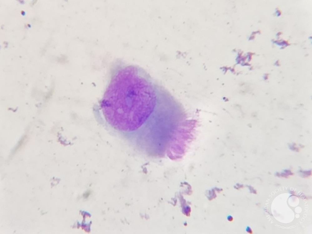 Nasal ciliated epithelial cell