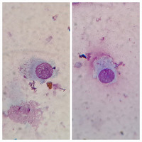 Goblet Cells