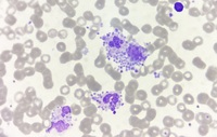 Platelet satellitism around leucocytes 1