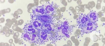Platelet satellitism around leucocytes 2