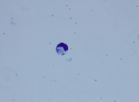 lymphocyte ingulfing bacteria 5