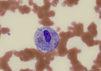 Macrophage with engulfed RBCs