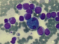 Binuclear Mott Cell