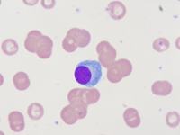 Plasma cell