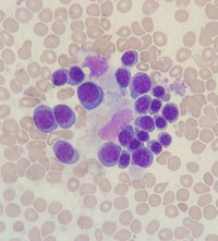 Erythroblastic Island (Nurse Cell)