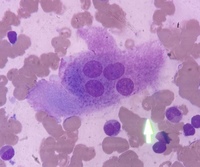 Osteoclast