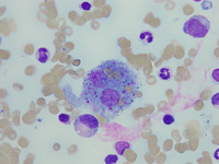 Erythrophagocytosis