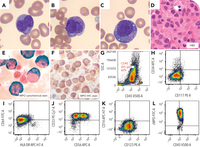 FISH-negative, karyotype-negative acute promyelocytic leukemia