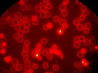 C. Fluorescence microscopy, 100x