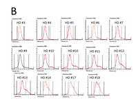 Panel B: Evolution of the RBC histogram in TTP