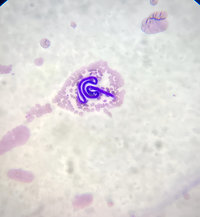 Microfilaria larvae 1