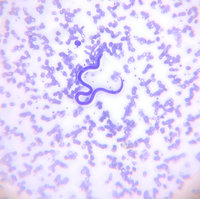 Microfilaria larvae 2