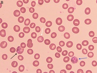 Plasmodium vivax multiple lifecycle stages