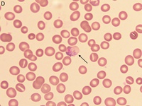 Plasmodium vivax trophozoite