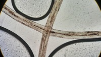 Image 2: Chediak-Higashi hair shaft