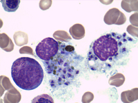 Amastigotes of Leishmania