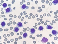 Macrophage with phagocytosed red blood cells