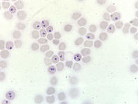 Plasmodium falciparum trophozoites