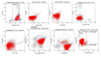 Blastic Plasmacytoid Dendritic Cell Neoplasm 4