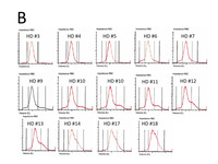 TTP - RBC histogram over time