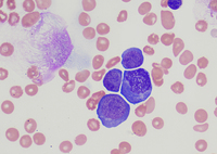 B- Erythroid precursors at different stages