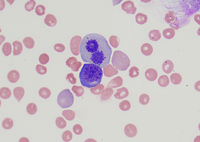 C- Basophilic erythroblast and mitosis