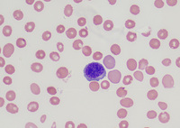 E- Polychromatic erythroblast