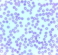 Ring form of Plasmodium falciparum