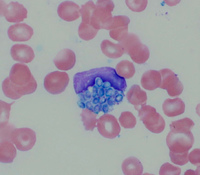 Fungal organisms in a leukocyte on a peripheral blood smear