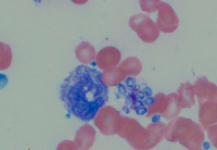 Fungal organisms on a peripheral blood smear